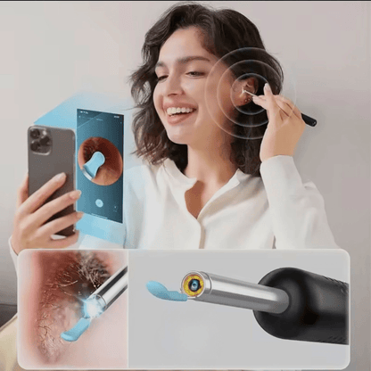 OídoPlus – Salud auditiva avanzada con limpieza profunda